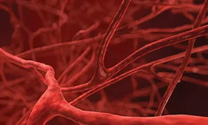 Bé gái bị động kinh do khối dị dạng mạch máu não Bé gái bị động kinh do khối dị dạng mạch máu não